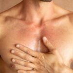 natural-remedies-for-thrombosis