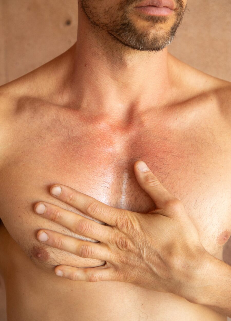 natural-remedies-for-thrombosis